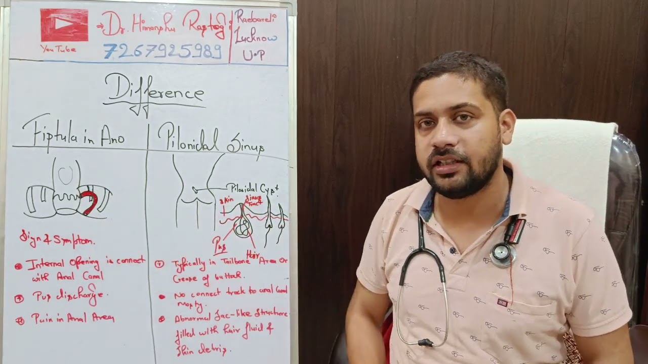 Fistula and pilonidal sinus difference.