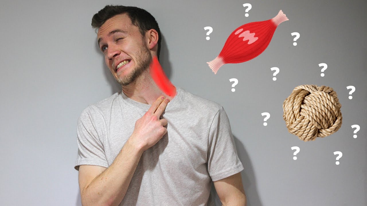 Trigger points? Muscle Knots? Physiotherapist Explains.