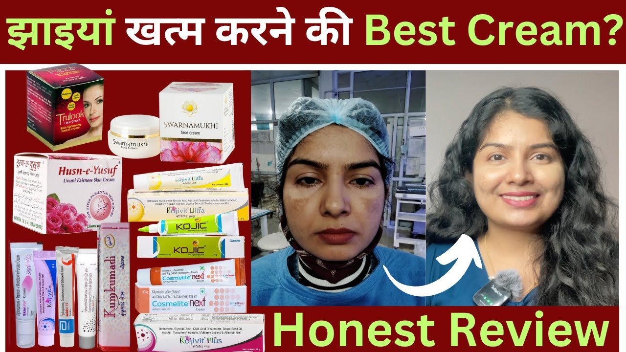 Pigmentation खत्म करने की Best Cream? सच जानें| Best Creams for Melasma| #drvandanaayulab #melasma