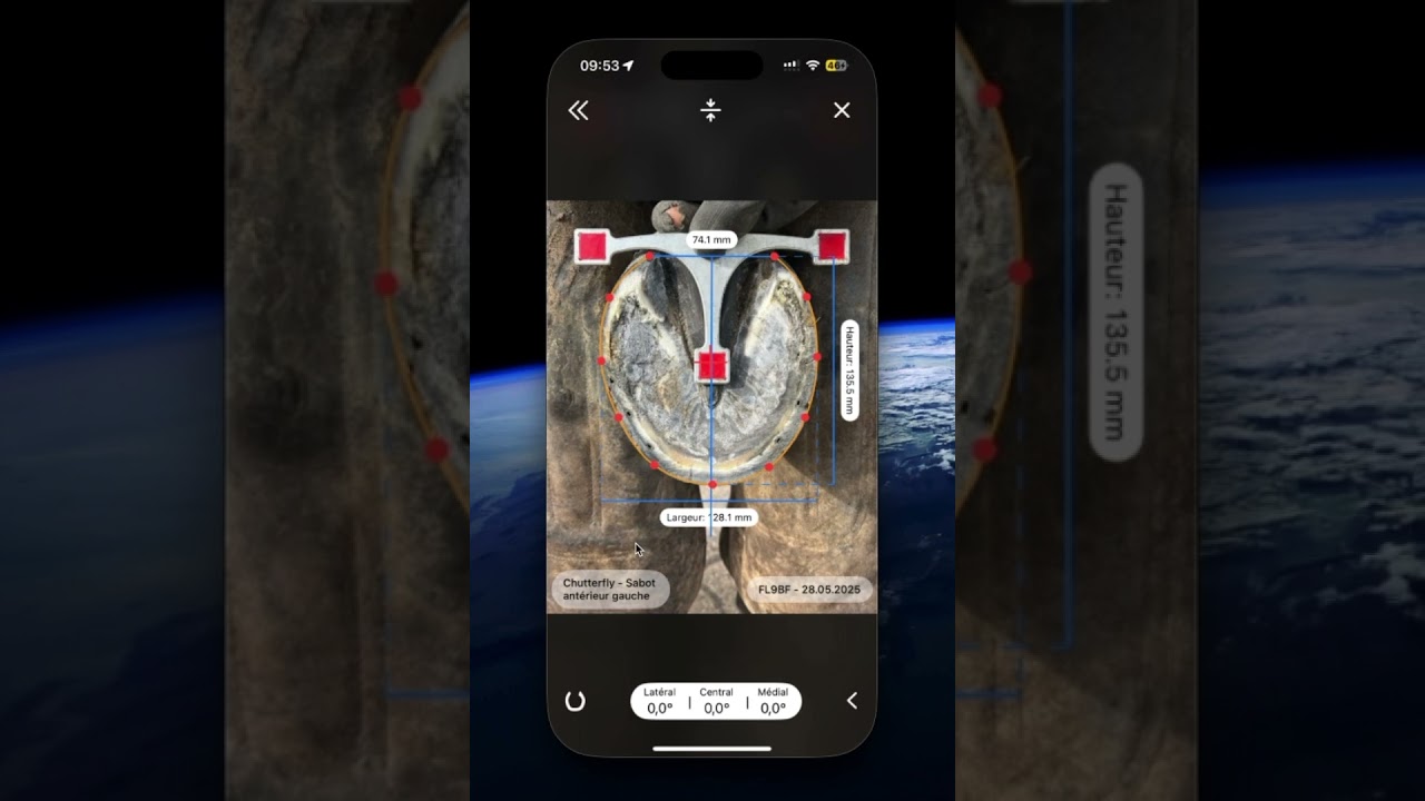 Orion Scan &ndash; Placement pr&eacute;cis des points des talons