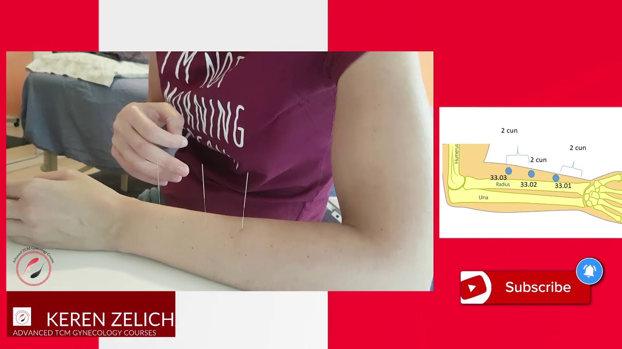 Master Tung's Acupuncture Points: 33.01 (Qi Men), 33.02 (Qi Jiao), 33.03 (Qi Zheng)