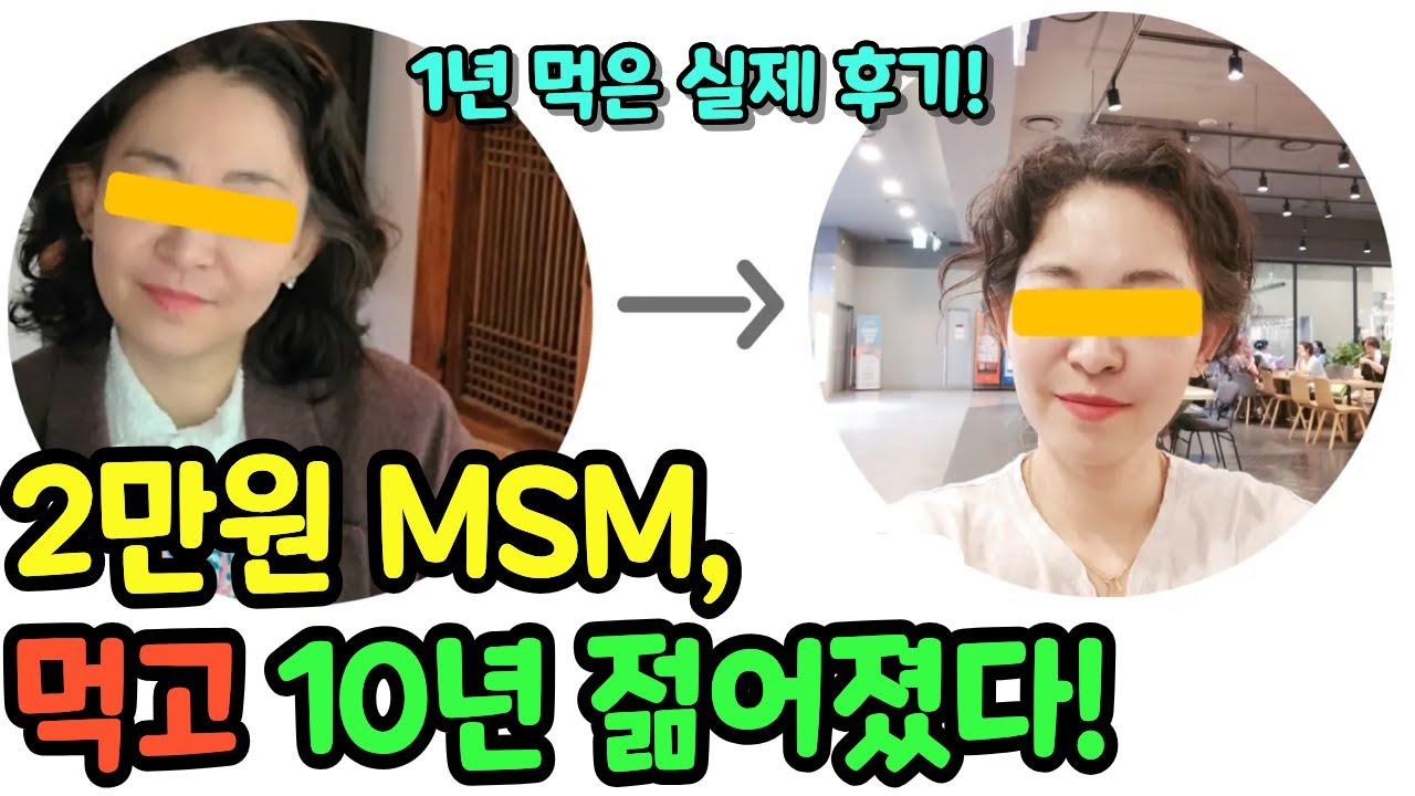 피부 영양제 MSM 피부 탄력 + 모발 굵기도 up! MSM 효능 복용법도 알려드려요! 저속노화 비법! #msm피부 #msm부작용
