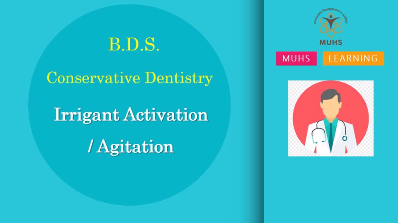 Irrigant Activation / Agitation | Conservative Dentistry | BDS | 00823 | PPT Only