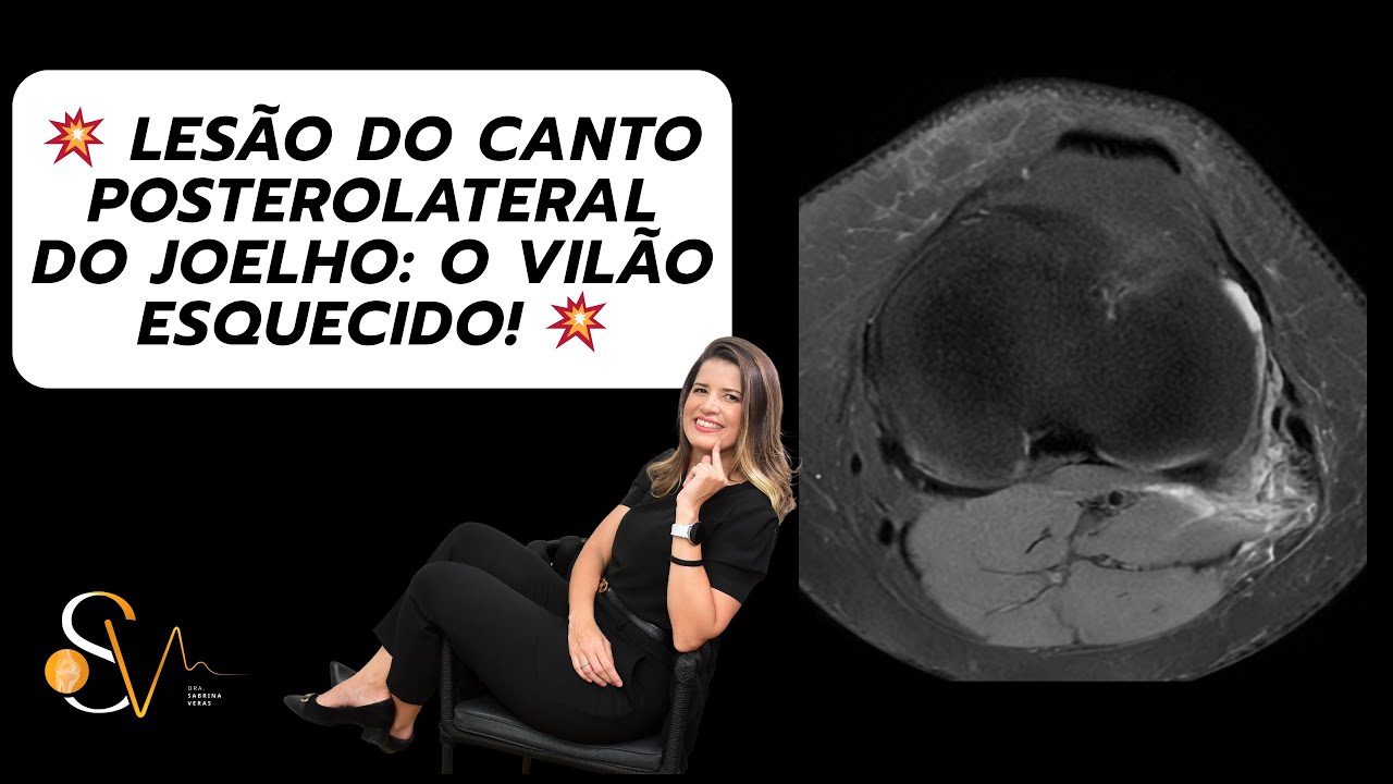 💥 Lesão do Canto Póstero-Lateral do Joelho: o vilão esquecido! 💥