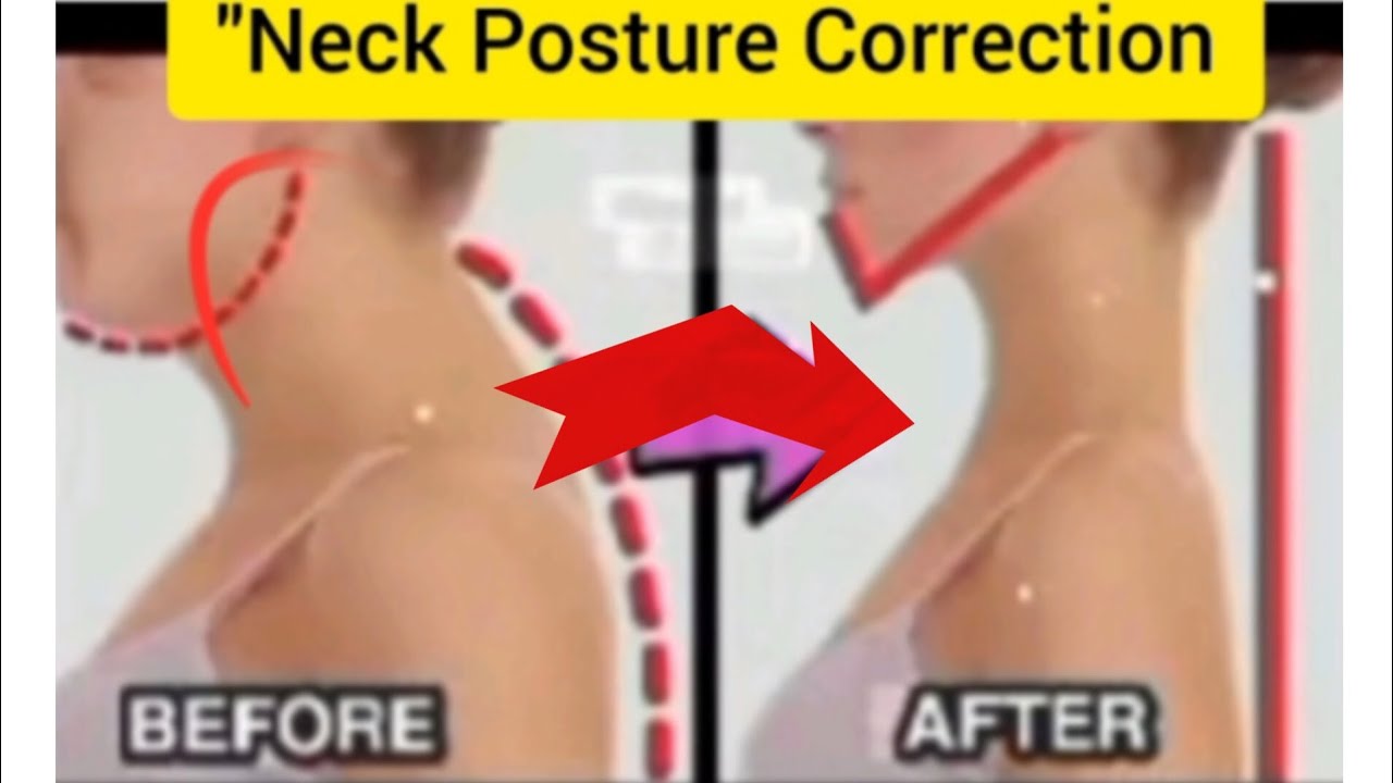 Neck posture correction and bags under eyes full training 💪🏻