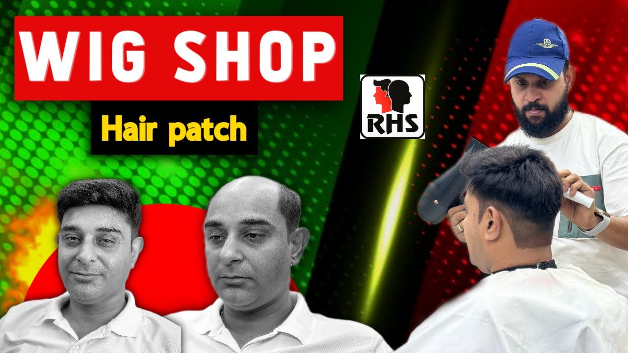 Best Hair Patch For Men | Best Hair Patch Centre | Natural  Hairline Patch | 9599858612