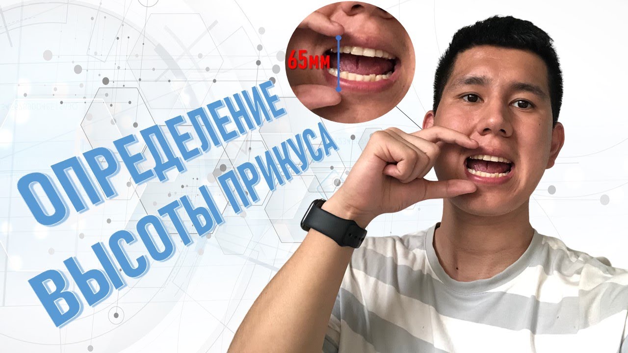 ОПРЕДЕЛЕНИЕ ВЫСОТЫ ПРИКУСА | РАСЧЁТ ПО ТРГ