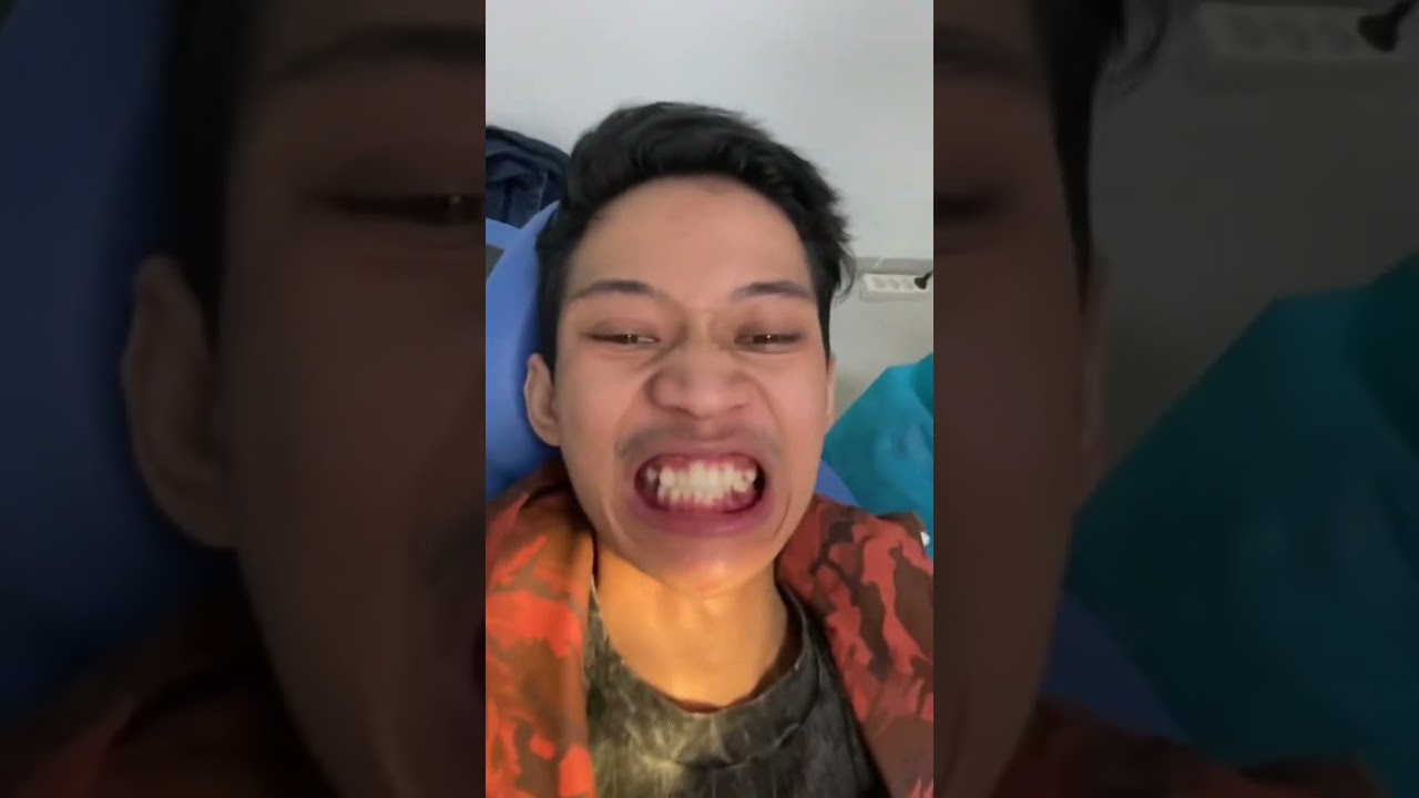 AKHIRNYA BY PASANG BEHEL🦷 #challenge