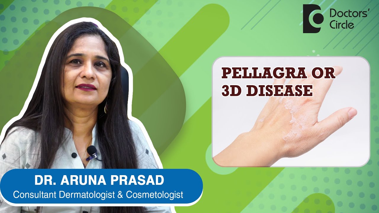 Vitamin B3 Deficiency | Why is pellagra called as 3D disease? - Dr. Aruna Prasad  | Doctors' Circle