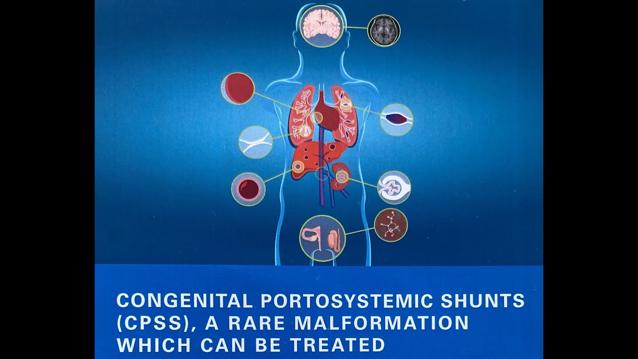Abernethy malformation and congenital portosystemic shunts