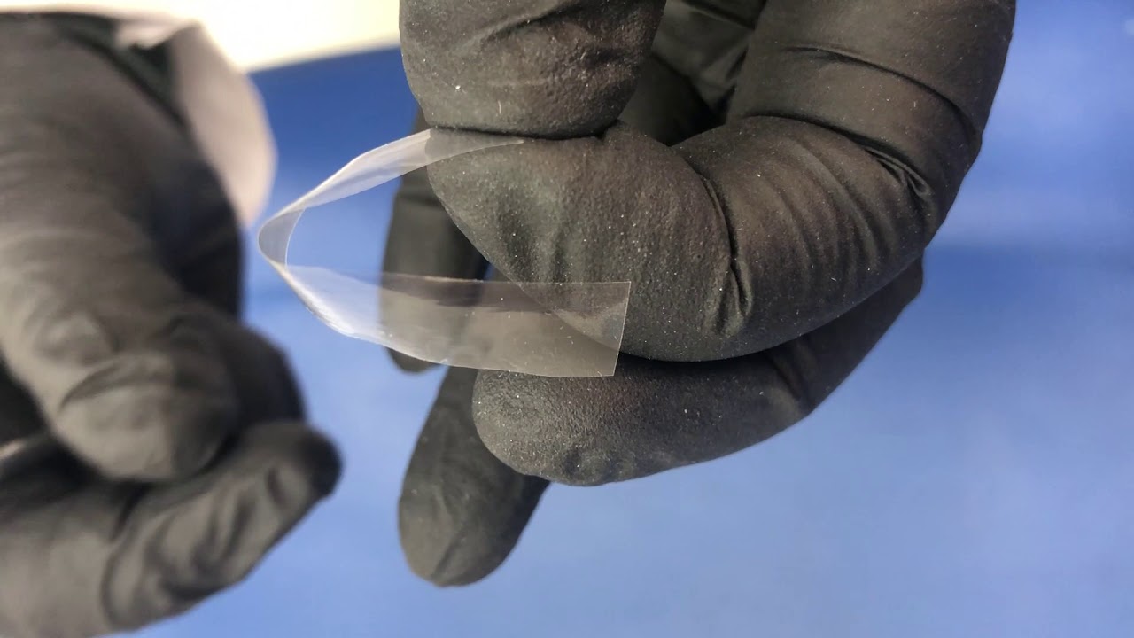 Guidelines for anterior resin composite restorations Part I (Class III)
