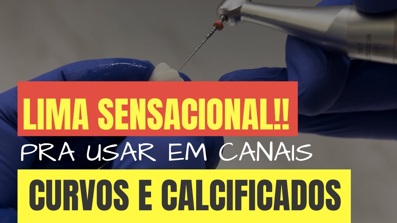 LIMA SENSACIONAL PARA CANAIS CURVOS E DIFÍCEIS!