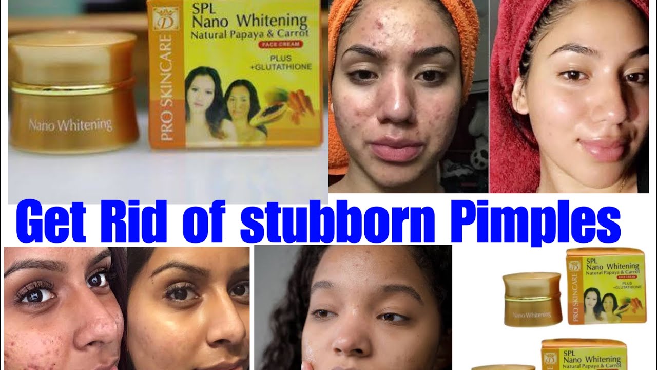 Nano whitening face cream review, How good is nano whitening face cream??  Does it clear sunburn?