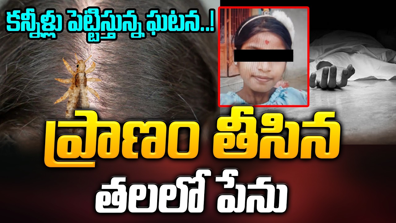 12 ఏళ్ల బాలిక ప్రాణం తీసిన తలలో పేలు! | Head Lice Infestation | Latest News | ManamTV