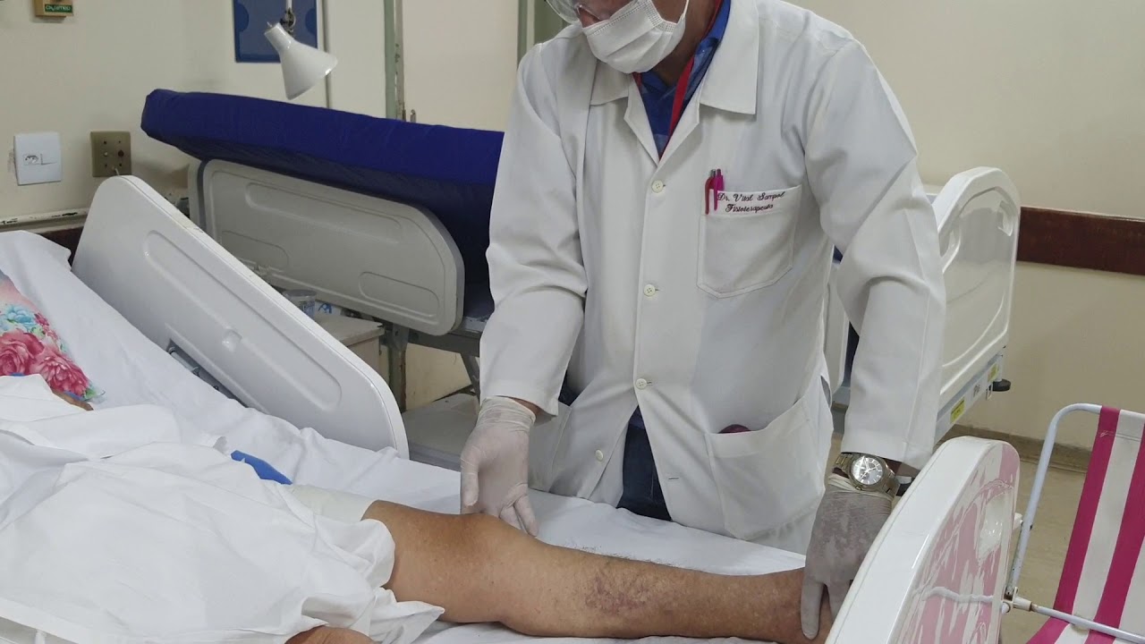 fisioterapia no pós operatório de fratura transtrocanteriana DHS