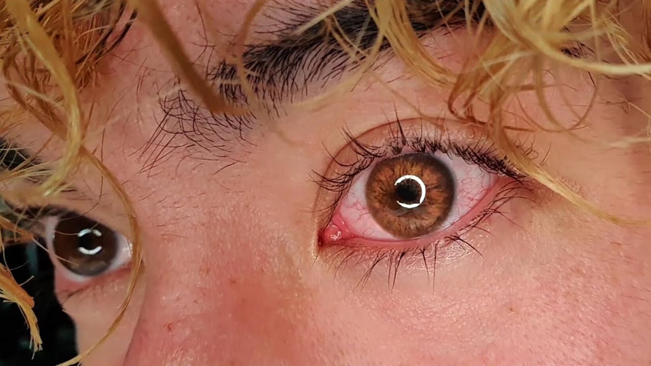 Beautiful Amber Contact Lenses For Dark Eyes / ColorCL Siesta Crystal Halo Amber | DPartyIsHere