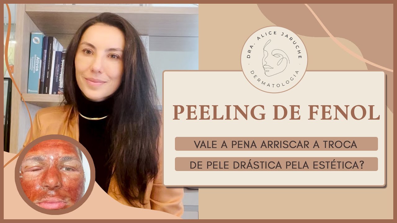 PEELING DE FENOL | Vale a pena arriscar a troca de pele drástica pela estética? - Dra. Alice Jaruche