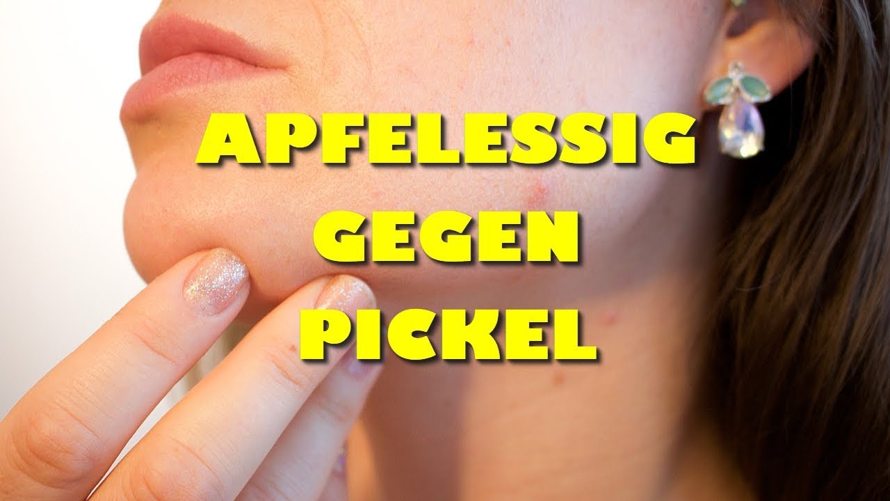 Apfelessig gegen Pickel &ndash; wie Du effektiv Deine Pickel mit Apfelessig loswirst