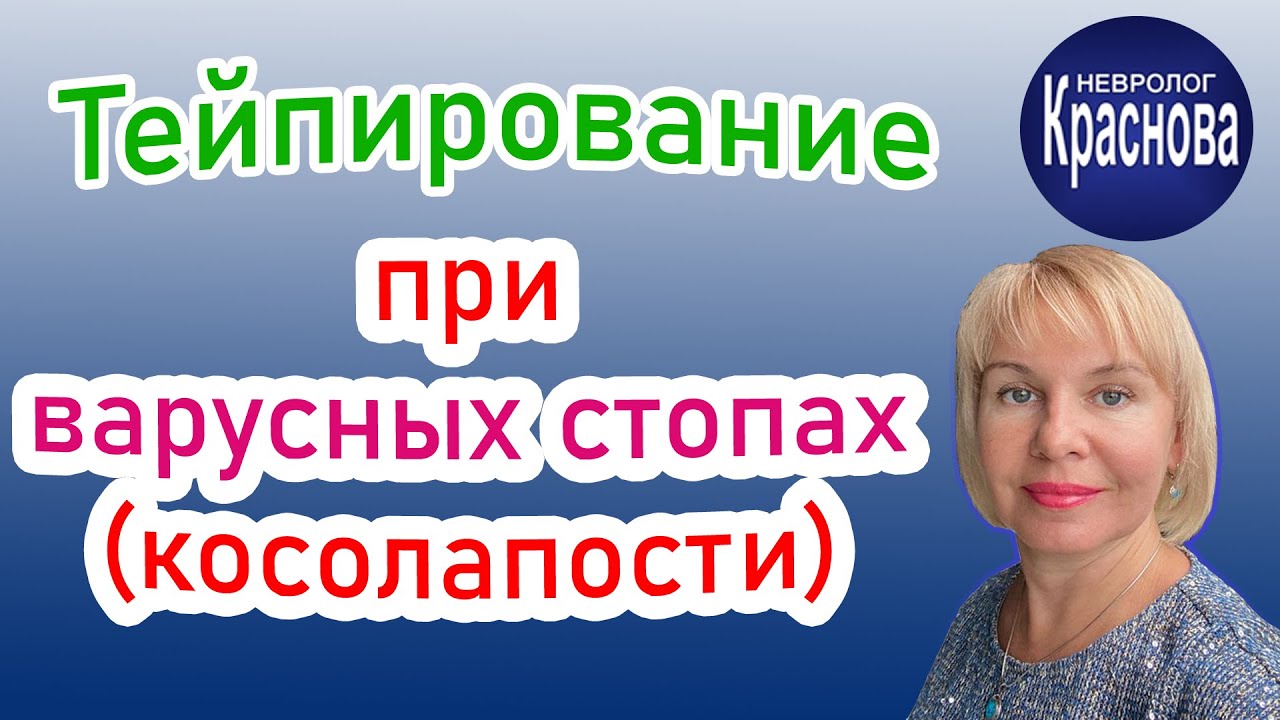 Тейпирование при варусных стопах (косолапости). Детский Невролог Краснова.