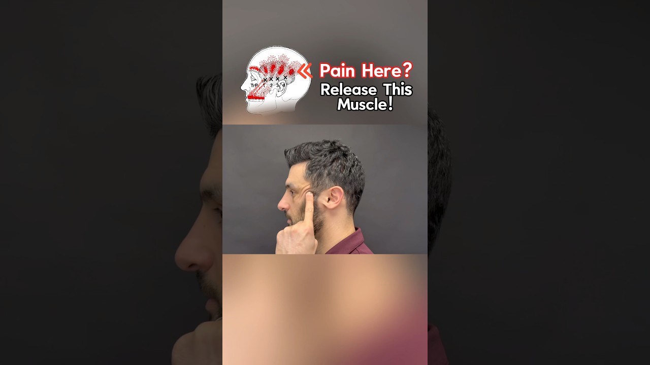 Try this Temporalis Release for Head, Face, or Jaw Pain! #tmjdisorder #tmjtreatment #jawpainrelief