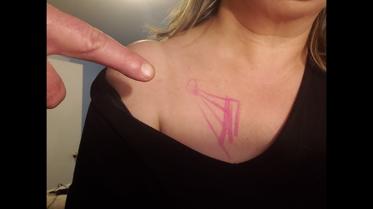 Shoulder Pain Caused By This Hidden Muscle? Pec Minor