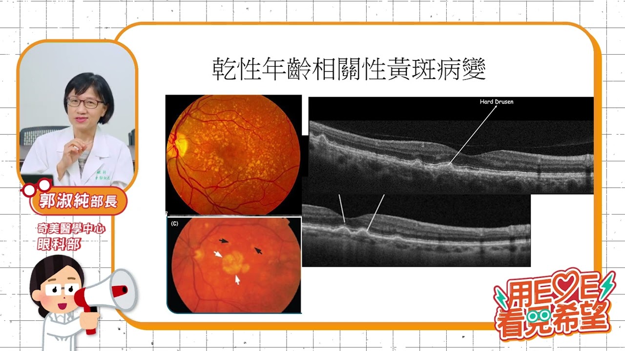 黃斑部病變治療與保健：奇美醫院郭淑純部長｜用Eye看見希望-視網膜名醫系列講座