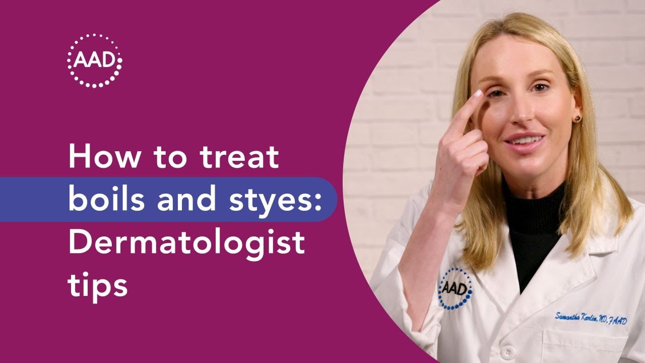 How to treat boils & styes: Dermatologist tips
