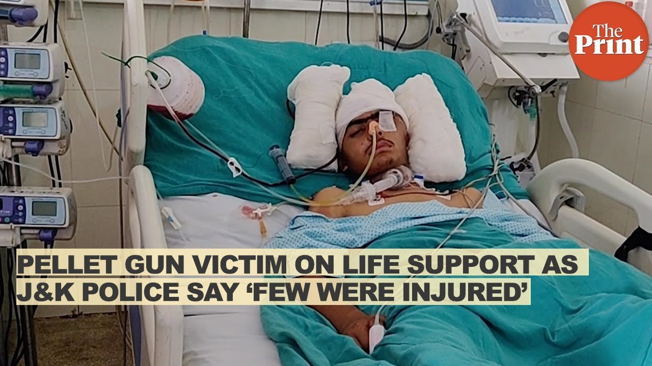 Pellet gun victim on life support as J&K police say ‘few were injured’