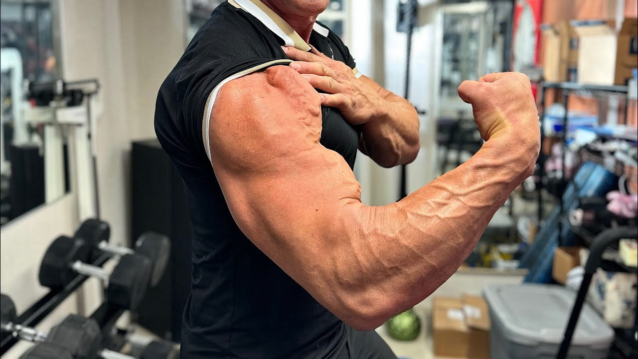 6 months post distal bicep surgery.  #biceps #surgeryrecovery #tear