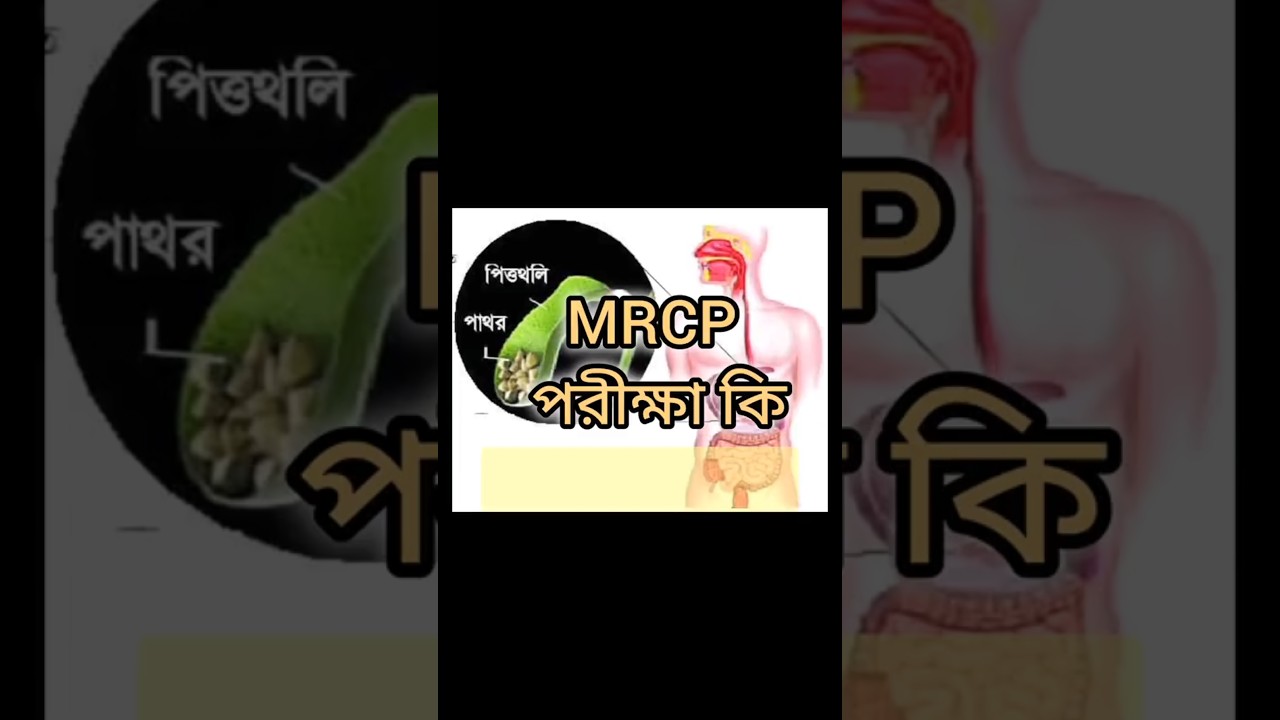 What Is MRCP #MRCP পরীক্ষা কি ?