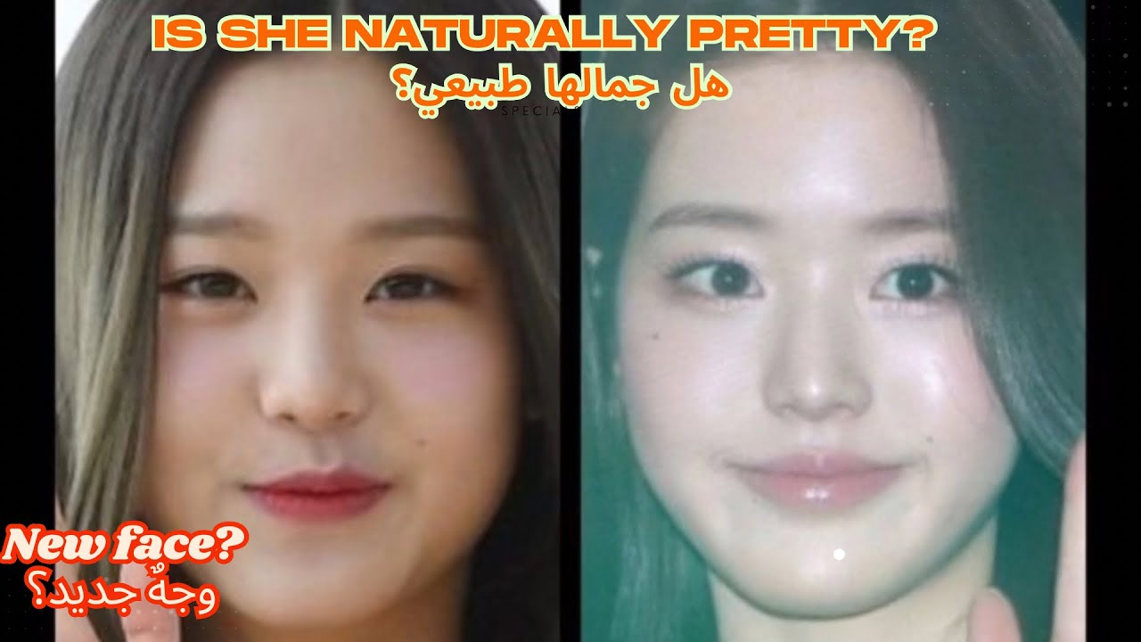 تحليل عمليات وونيونغ عضوة فرقة آيڤ الكورية | Analysing Ive wonyoung's plastic surgeries