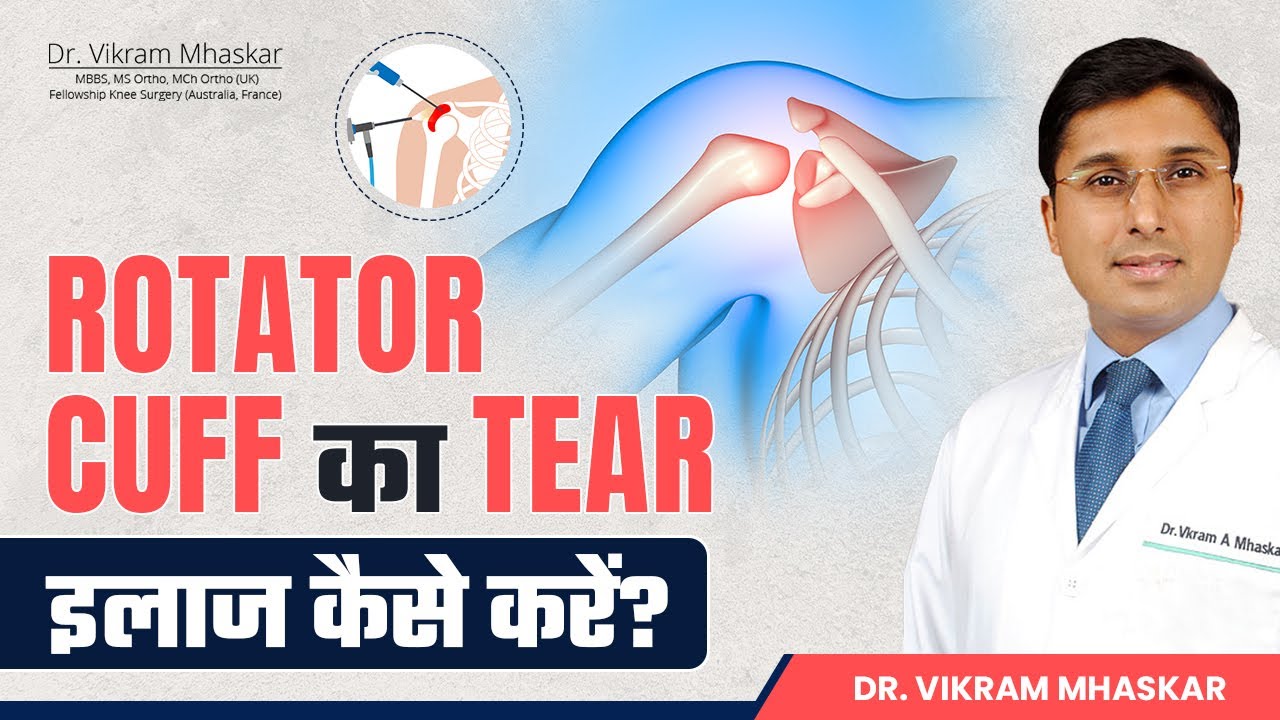Rotator Cuff Injury Explained in Hindi|रोटेटर कफ की चोट के लक्षण और उपचार |Shoulder Pain Relief Tips