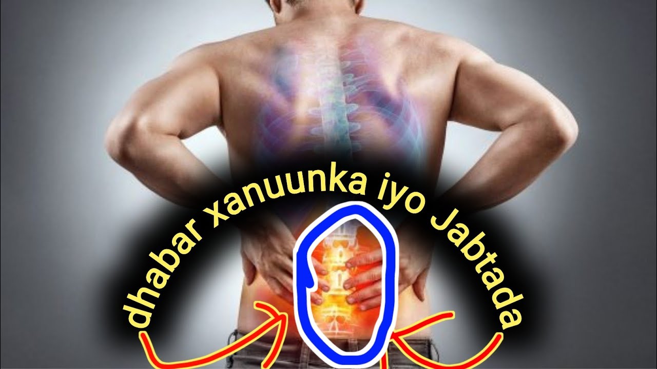 Xanuunka jabtada waxa uu kuugu sababo karaa dhabar xanuun , qoyaan ka yimaado xubinta taranka......