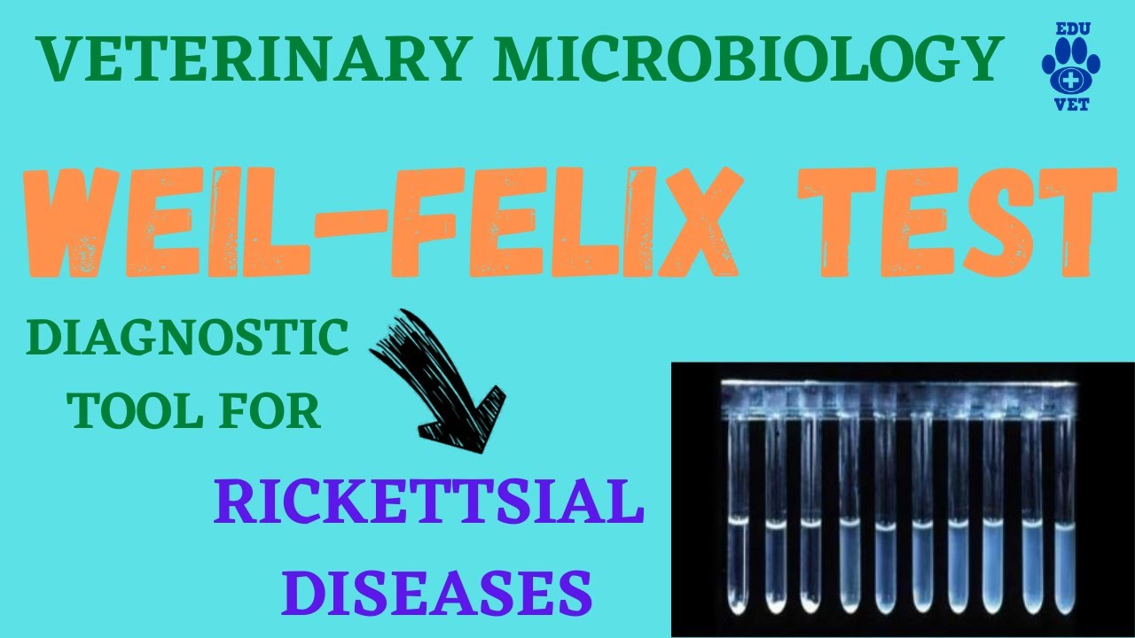 Weil-Felix Test ! Diagnosis for Rickettsiosis