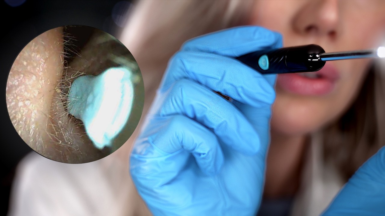 Close-Up ASMR | Deep Ear Exam (actual ear footage with wax removal)