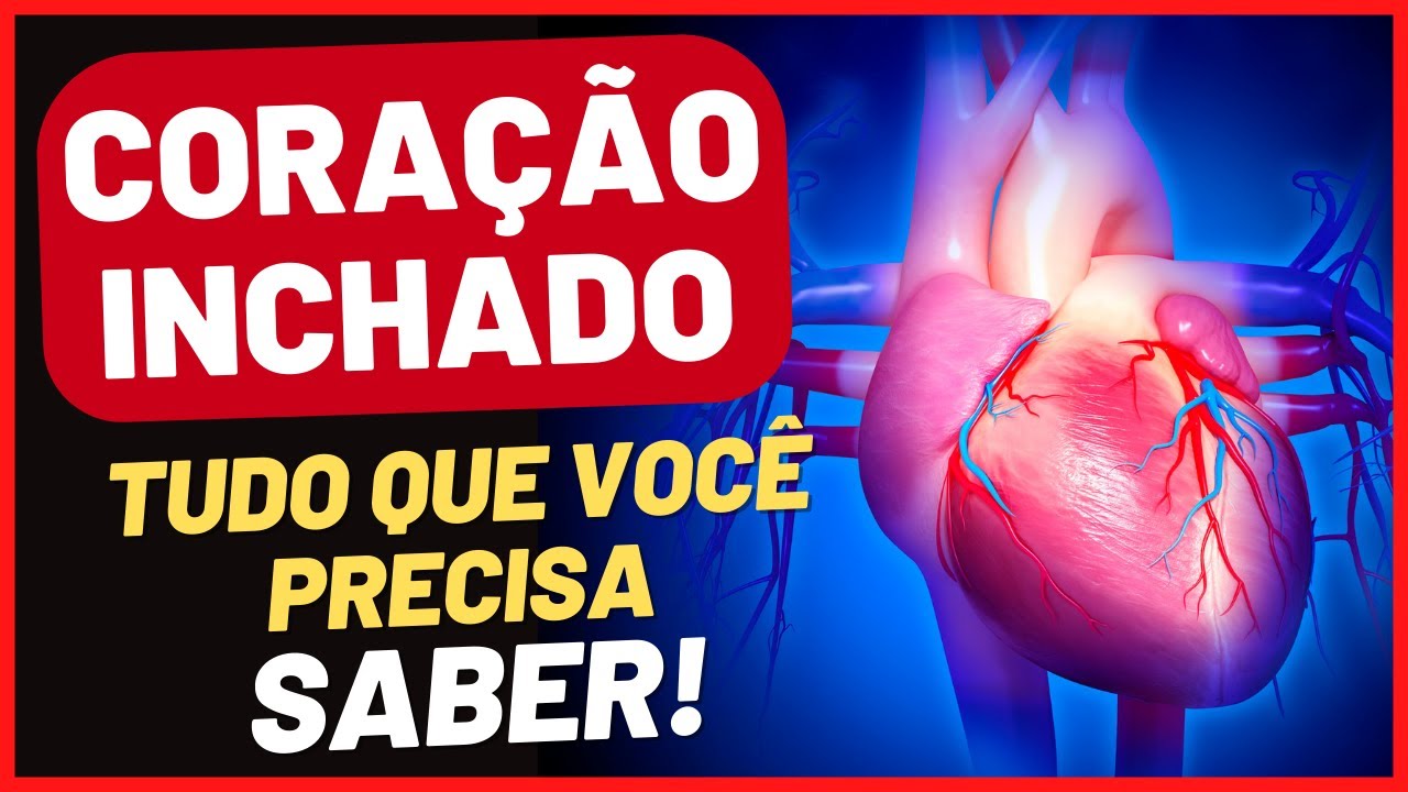 CORAÇÃO GRANDE CRESCIDO DILATADO INCHADO | O que é | CAUSAS | SINTOMAS | no RX | TEM TRATAMENTO