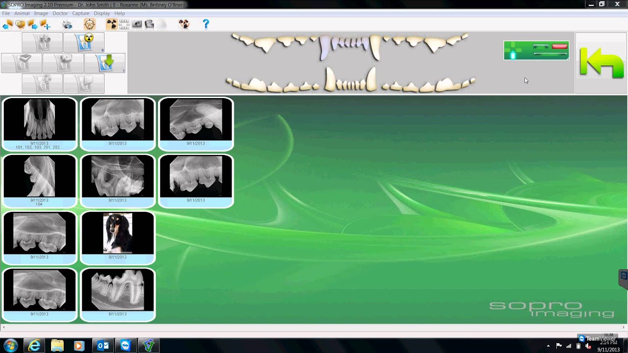 Sopix SOPRO Software: Entering New Patient & Shooting X Rays by Dental Focus LLC