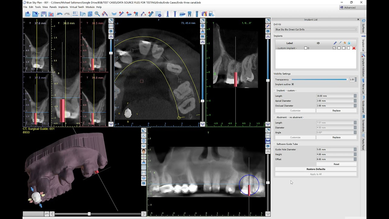BSP - Creating an Endo Guide with Existing Functionality
