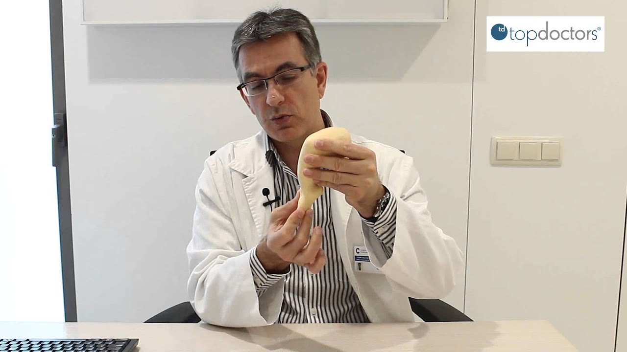 Pie equinovaro: definición, diagnóstico y tratamiento