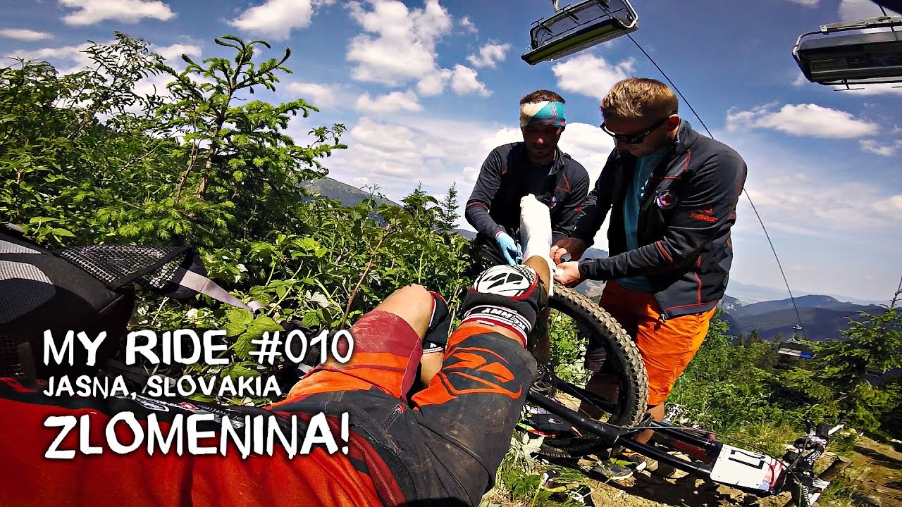 Jasná zlomenina! | Matej Charvat - MY RIDE 010