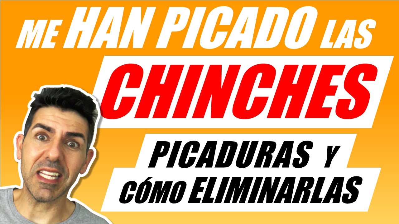 CHINCHES DE CAMA - Mis picaduras y consejos para eliminar las chinches