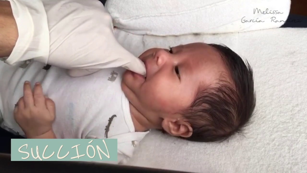 Terapia orofacial en neonatología