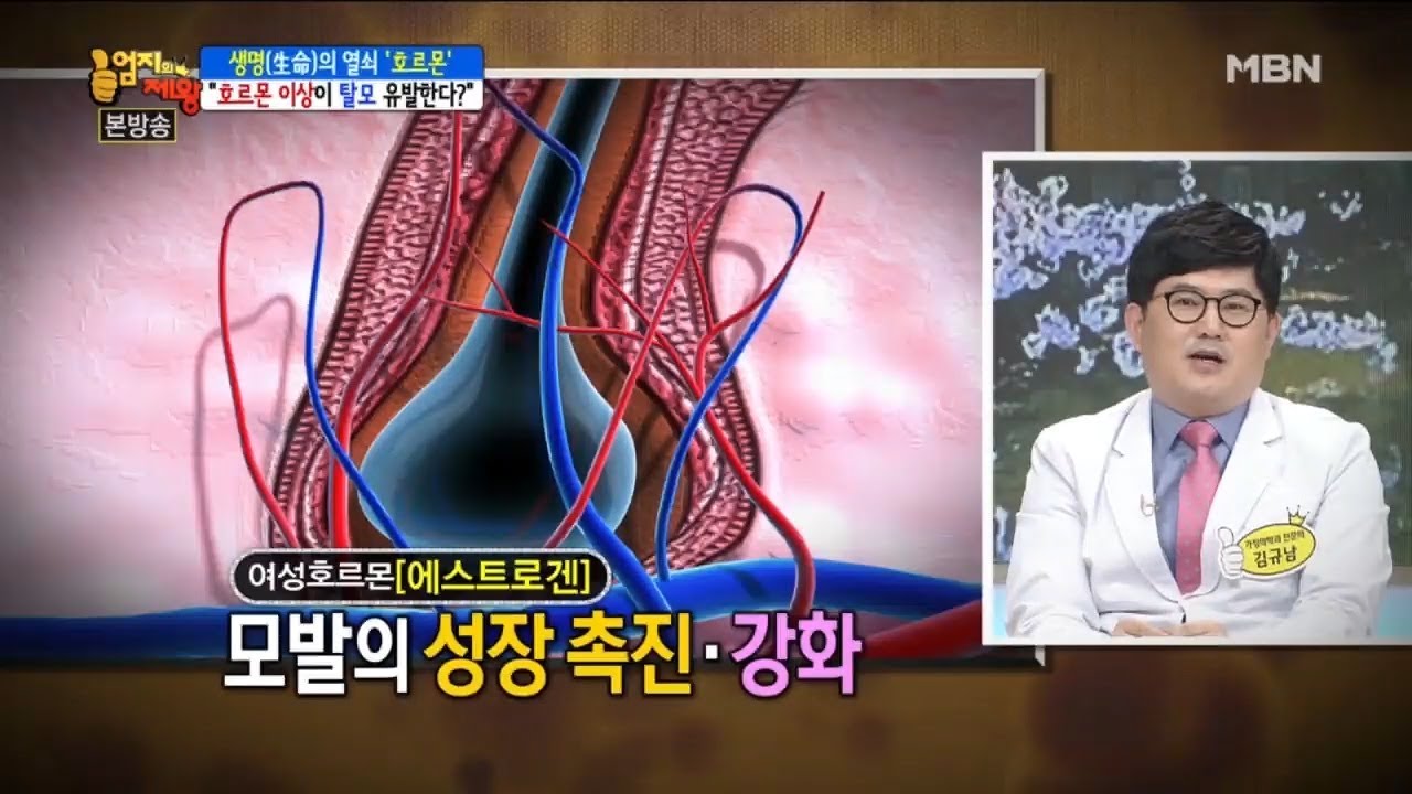 여성 탈모가 증가하는 이유 [엄지의 제왕 121회]