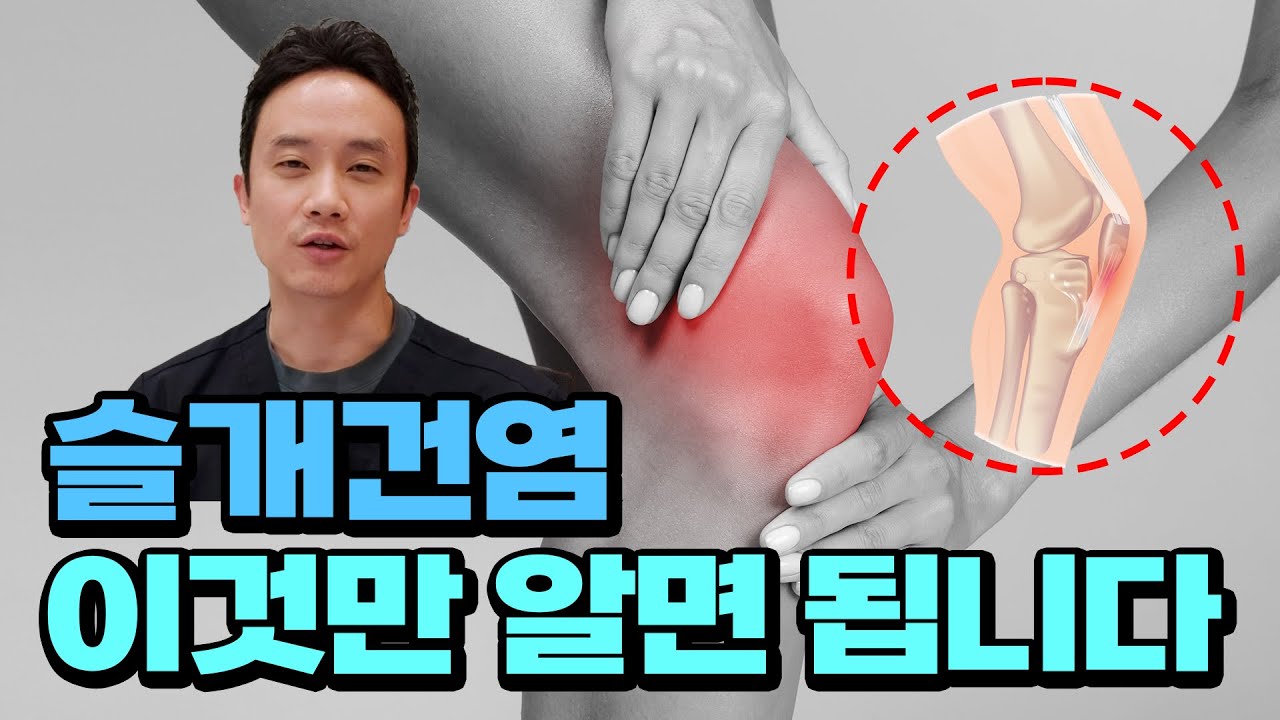 슬개건염 환자분에게 가장 도움이 되는 3가지 질문
