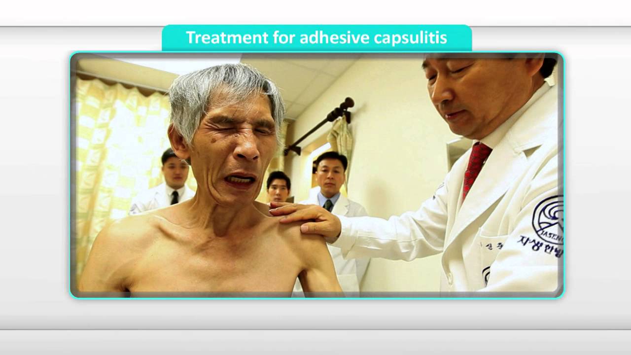 [Treatment] Treatment for Adhesive Capsulitis of shoulder
