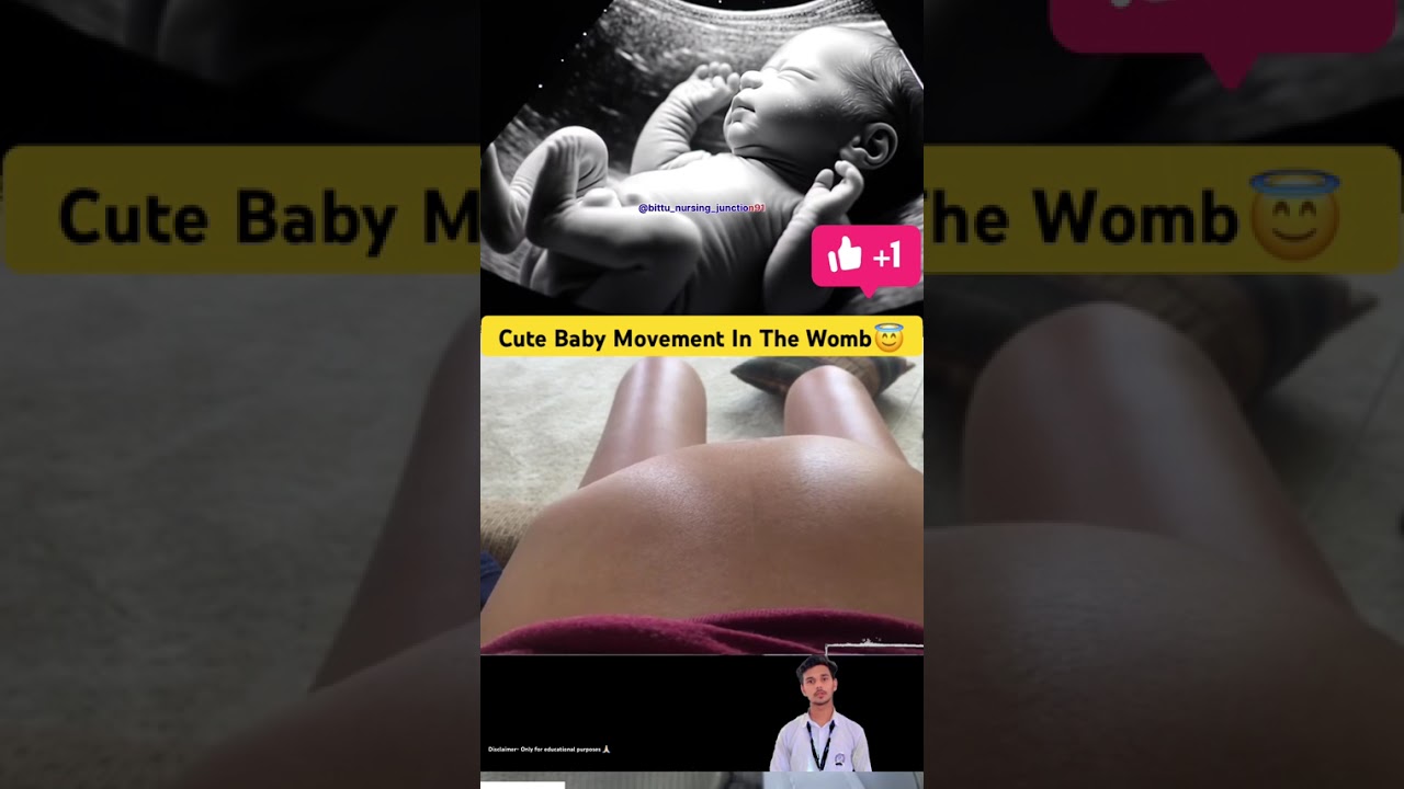Cute Baby Movement In The Womb😇 | Educational Video #babycare #pregnancy #viral #shorts #shortsfeed