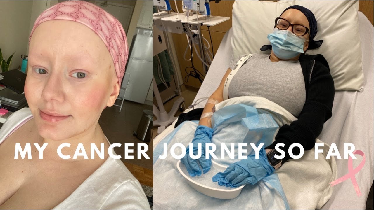 Breast Cancer at 25: They Told Me I Was Too Young!