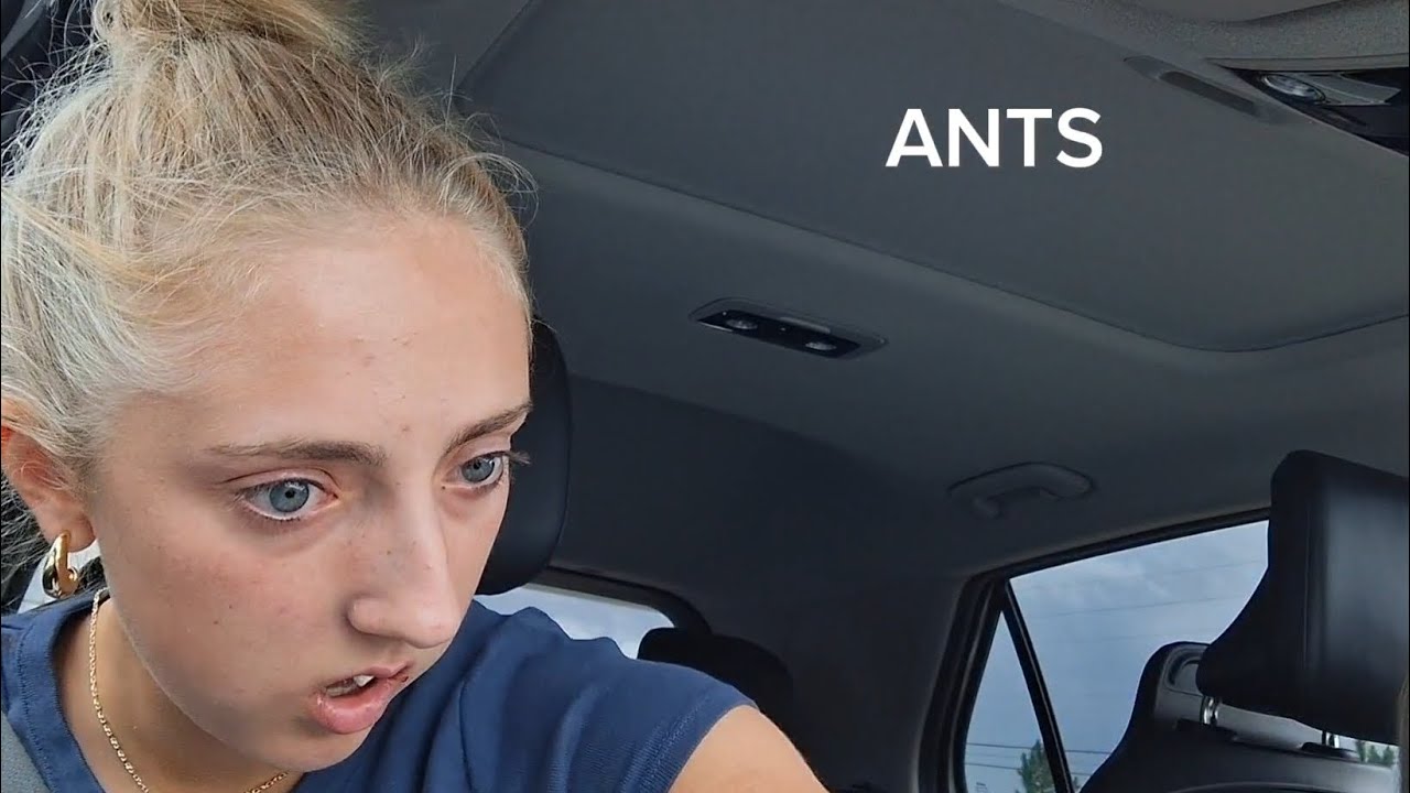 I GOT MY WISDOM TEETH REMOVED 