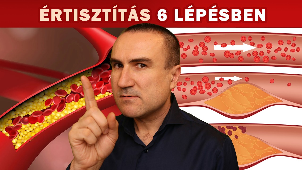 6 l&eacute;p&eacute;s az erek megtiszt&iacute;t&aacute;s&aacute;hoz