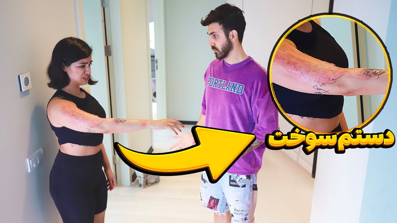 دوربین مخفی 🧨 پوستم سوخت
